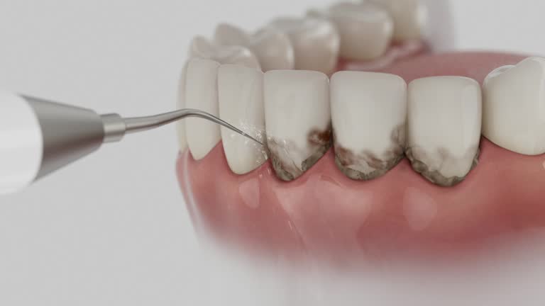 Trusted Teeth Cleaning And Checkup service in Elmwood, LA - Dentist Open Now